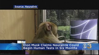 Elon Musk says Neuralink brain implant could begin human testing