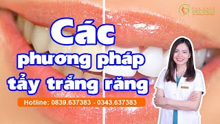 Các phương pháp tẩy trắng răng tốt nhất - Review Tẩy Trắng