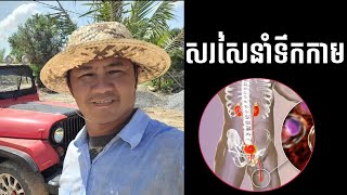 សរសៃនាំទឹកកាម /CAM Health/