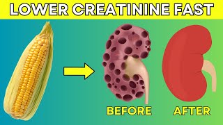MUST EAT! Lower Creatinine Fast With 5 These Superfoods  | PureNutrition