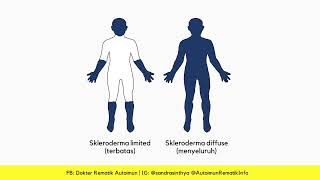 SKLERODERMA DAN KOMPLIKASINYA