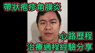 分享帶狀疱疹角膜炎,心路歷程,治療過程經驗分享,Shingles in the Eye Infection.My story and my treatment.