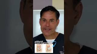Breast Implant Issues | Animation Deformity