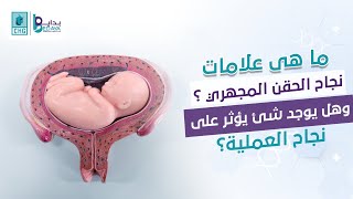 ما هى علامات نجاح الحقن المجهري ؟ وهل يوجد شئ يؤثر على نجاح العملية؟