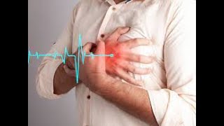 These are top 6 heart attack signs in women, doctor reveals
