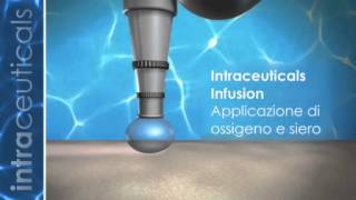 Intraceuticals Rejuvenate Oxygen Italian: Oxygen Facials