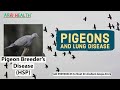 Dr. Anshum Aneja Arora | Pigeon related lung disease | Hypersensitivity Pneumonitis (HSP)