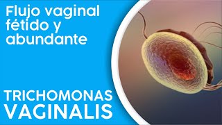 Trichomonas Vaginalis - tricomoniasis ITS