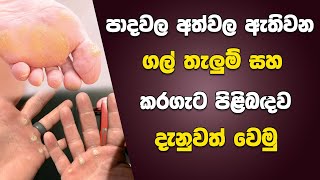 පාදවල අත්වල ඇතිවන ගල් තැලුම් සහ කරගැට පිළිබඳ ව දැනුවත් වෙමු | Corns and Calluses in Hands and Feet