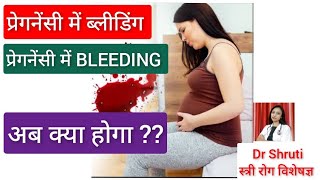 Bleeding in pregnancy in hindi ।। प्रेगनेंसी में ब्लीडिंग