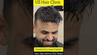 US Hair Fixing Udaipur 9461855711,9460758987Hair patch start only 3500/-Hair patch Dealer & Supplier