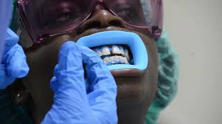 From a brighter smile to a little sparkle -Wilma's GOMC Experience