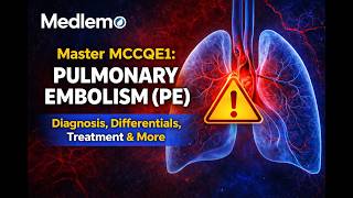 Master MCCQE1 tips : Pulmonary Embolism (PE) Diagnosis, Differentials , Treatment and More.