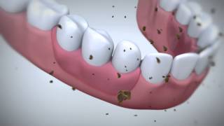 How does Fixodent denture adhesive work?