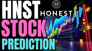 HONEST COMPANY STOCK PREDICTION (HNST STOCK Market Advice Today) Invest Aggressive Stocks to Buy Now