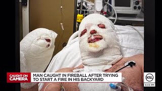 ‘Ball of fire’: Utah man severely burned during backyard accident with gasoline