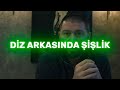 lipödem nedir lipödem olduğunuzu nasıl anlarsınız belirtiler ve Çözümler