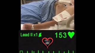 Patient Shocked into Sinus Rhythm