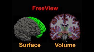 FreeSurfer #6: Freeview