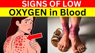 #8 Signs You Have Low Oxygen Levels In Your Blood You MUST NOT Ignore – This Could SAVE Your Life