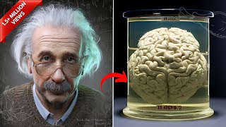 How Albert Einstein's Brain was different from other Human beings?