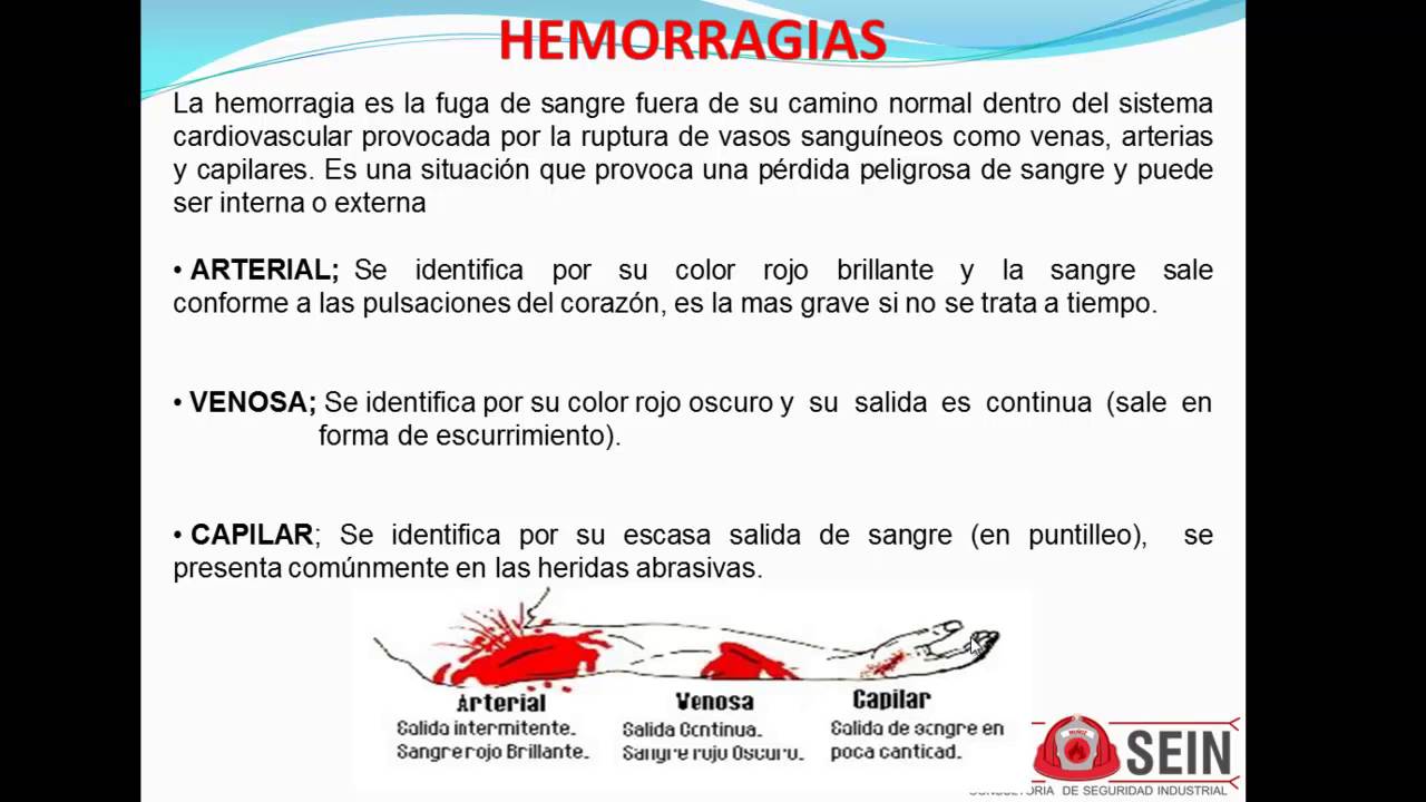 Hemorragias Youtube