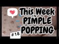 This Week In POPS! #18