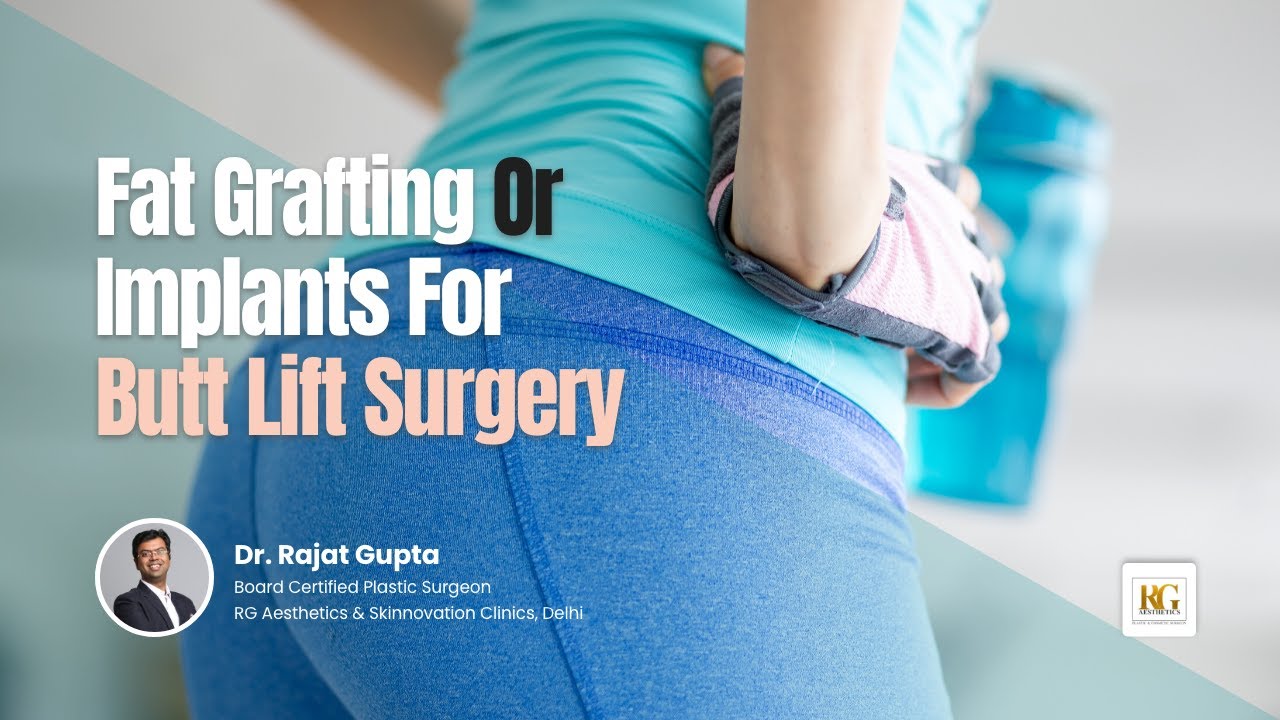 Butt Implants OR Fat Grafting | Butt Lift (BBL) Surgery | Body ...