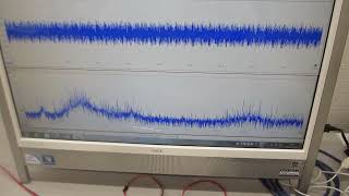 メガヘルツの超音波発振制御プローブを製造する技術ーーステンレス容器の表面弾性波を制御する技術を応用ーー（超音波システム研究所）