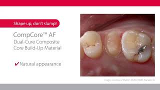 CompCore™ AF Dual-cure Composite Core Build-up Material