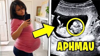 Aphmau is HAVING A BABY.. (PREGNANT!)