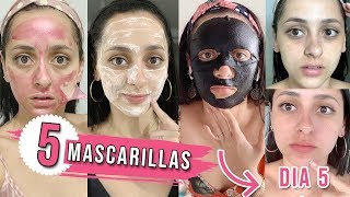 5 Mascarillas en 5 Días RESULTADOS INCREÍBLES 100% Reales😱