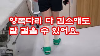 양쪽다리 깁스(Both Short Leg Cast \u0026 Splint) 후 보행