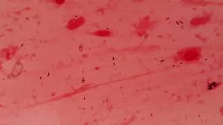 Gram positive cocci in sputum specimen I Gram stain