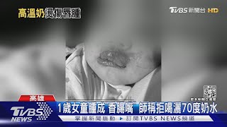 高雄1歲女童腫成「香腸嘴」母提告 師稱拒喝奶灑70度奶水｜TVBS新聞