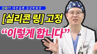 실리콘링 삽입술받으면 피부에 고정을 하나?