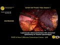 Laparoscopic sleeve gastrectomy with concurrent splenectomy