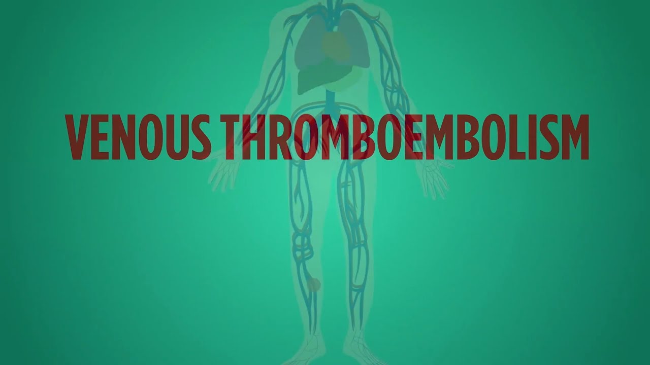 Venous Thromboembolism Explained In 60 Seconds - YouTube