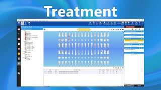 ABELDent: Treatment