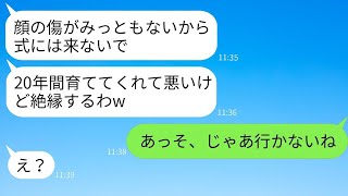 20年間育てた義理の母を、顔に傷があるからと結婚式に呼ばない娘「絶対来るなw」→母が言う通りに式を欠席した結果がwww