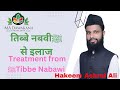 तिब्बे नबवीﷺ से इलाज (Treatment from Tibbe Nabawiﷺ) @MADAWAKHANAHIJAMACENTER