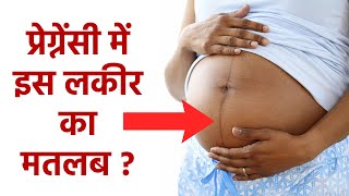 प्रेग्नेंसी में पेट पर लाइन का मतलब | Pregnancy Me Pet Par Line Ka Matlab | Boldsky