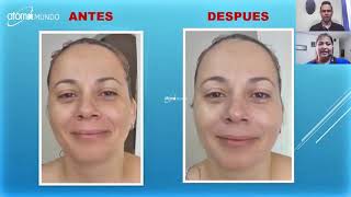 Especiales e Impresionantes Testimonios con Productos ATOMY