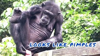 I seem to have pimples ……|Chimpanzee Daily|Taipei zoo