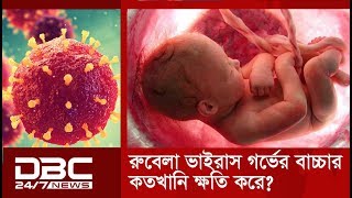 রুবেলা ভাইরাস গর্ভবতী মায়ের জন্যে কতোটা ক্ষতিকর