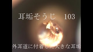 耳垢そうじ/ガサガサする大きな耳垢/103