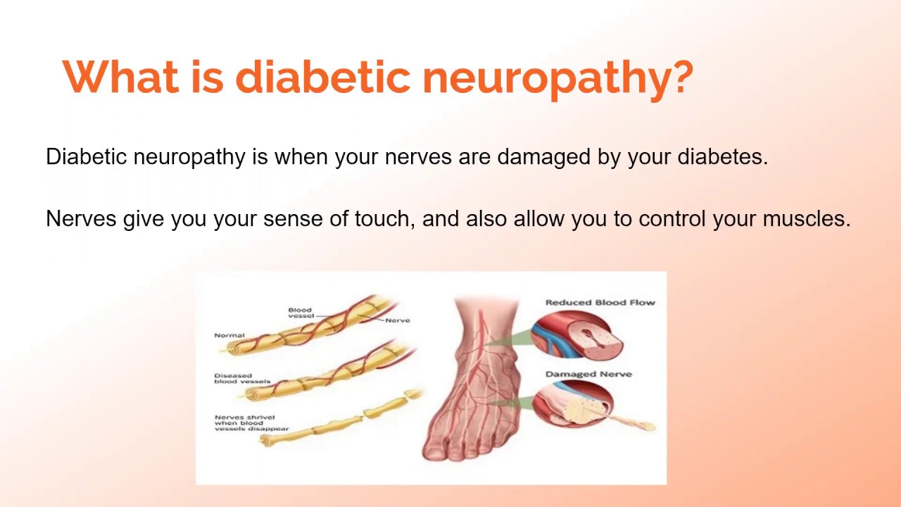 Diabetic Neuropathy: An Introduction - YouTube