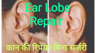 Ear hole Repair कान का छेद छोटा / ear pasting / ear lobe repair