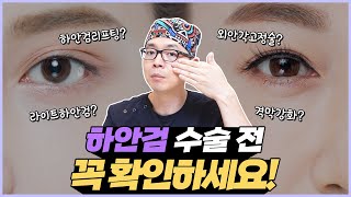 동안 눈매 만들기 위해 하안검 수술을 고민한다면 꼭 확인해보세요!│하안검 수술 전 필수 시청 영상✨