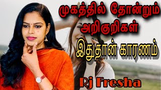 முகத்தில் தோன்றும் அறிகுறிகளுக்கு காரணம் | Face Treatment | Healthy Tips | Sooriyan FM | Rj Fresha